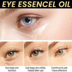 8ml Anti Wrinkle Eye Essence Oil Removal Dark Circles Eye Bags Moisturizing Tightening Whitening Skin Serum Eye Care Dropship