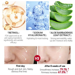 5pcs Jelly Mud Face Mask Hyaluronic Acid Moisturizing Gel Mask Deep Cleansing Remove Blackheads Acne Shrink Pores Skin Care