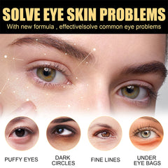 8ml Anti Wrinkle Eye Essence Oil Removal Dark Circles Eye Bags Moisturizing Tightening Whitening Skin Serum Eye Care Dropship