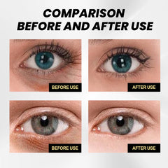 8ml Anti Wrinkle Eye Essence Oil Removal Dark Circles Eye Bags Moisturizing Tightening Whitening Skin Serum Eye Care Dropship